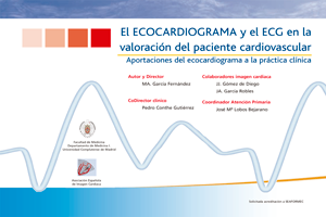 Ecocardiograma
